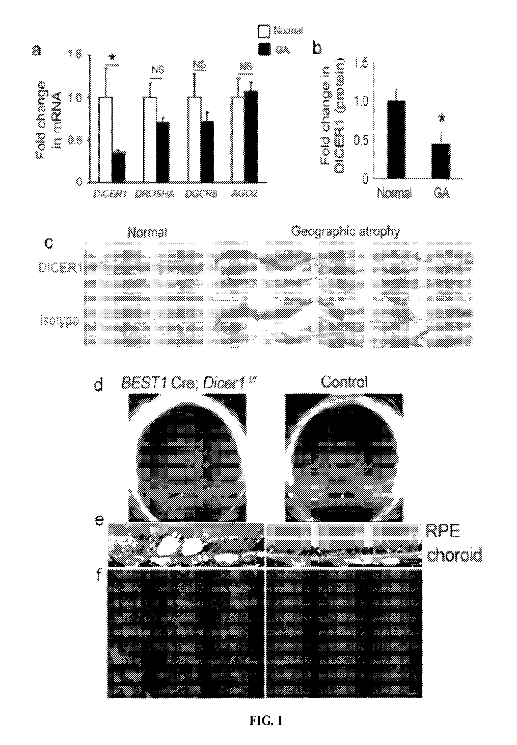 Method of inhibiting Alu RNA and therapeutic uses thereof