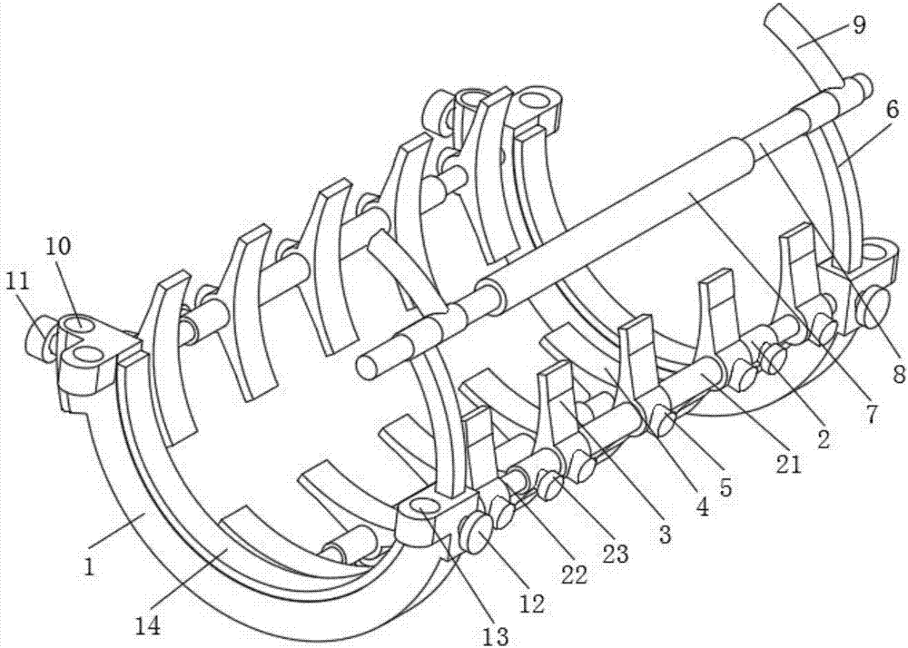 Orthopedic external fixing device