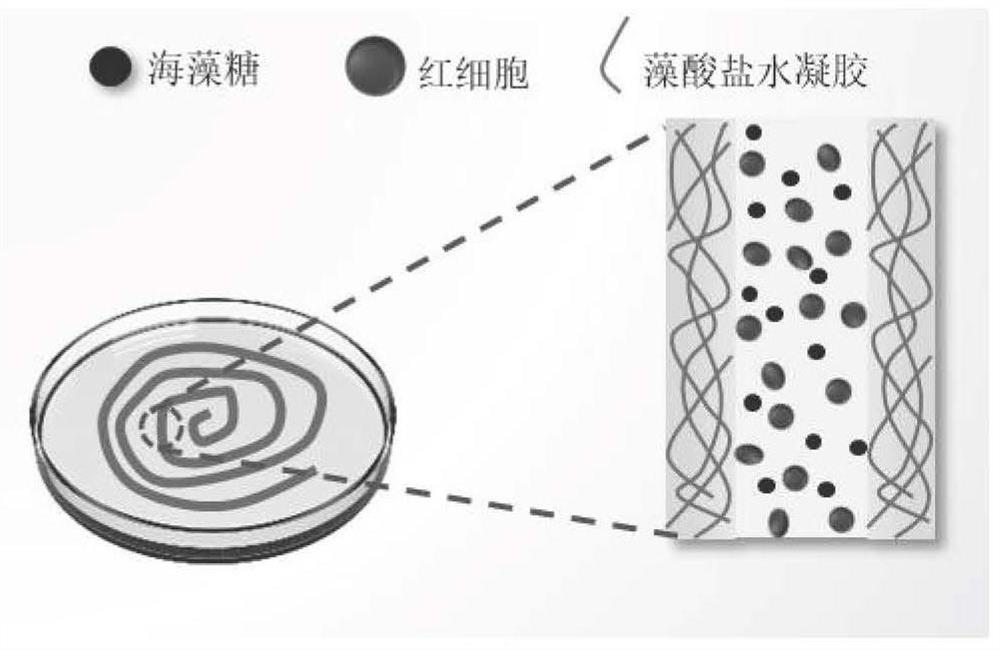 Erythrocyte cryopreservation method and cryopreserved erythrocytes