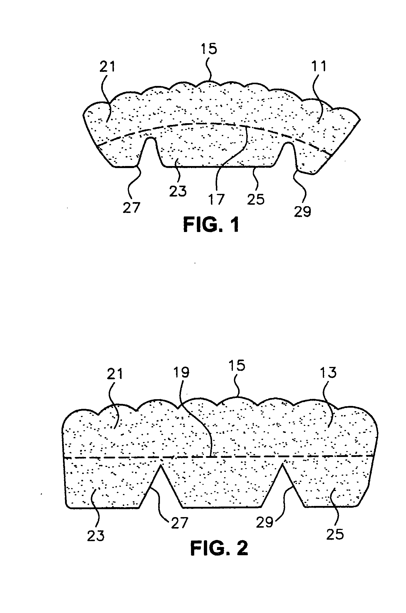 Teeth treatment devise