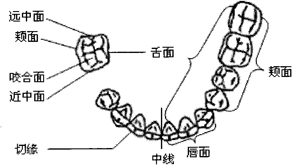 Method for determining container of single tooth