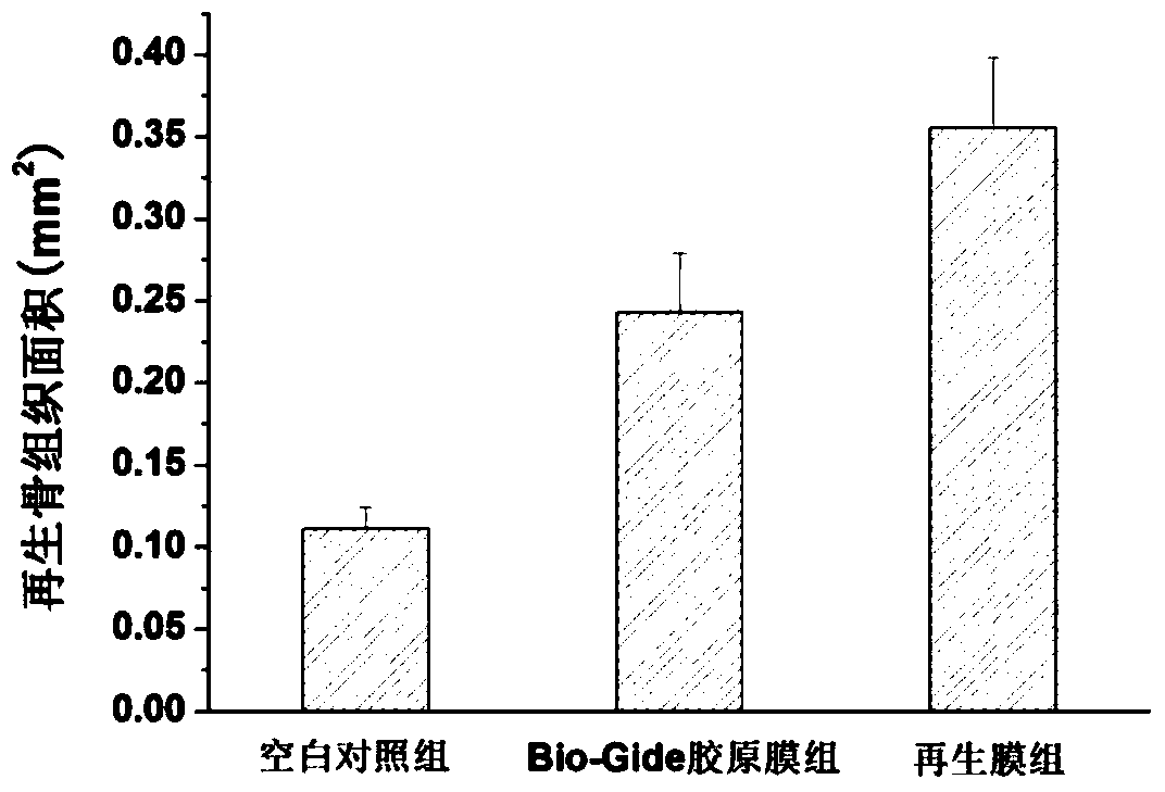 A biofilm for guided periodontal tissue regeneration and its preparation method and application