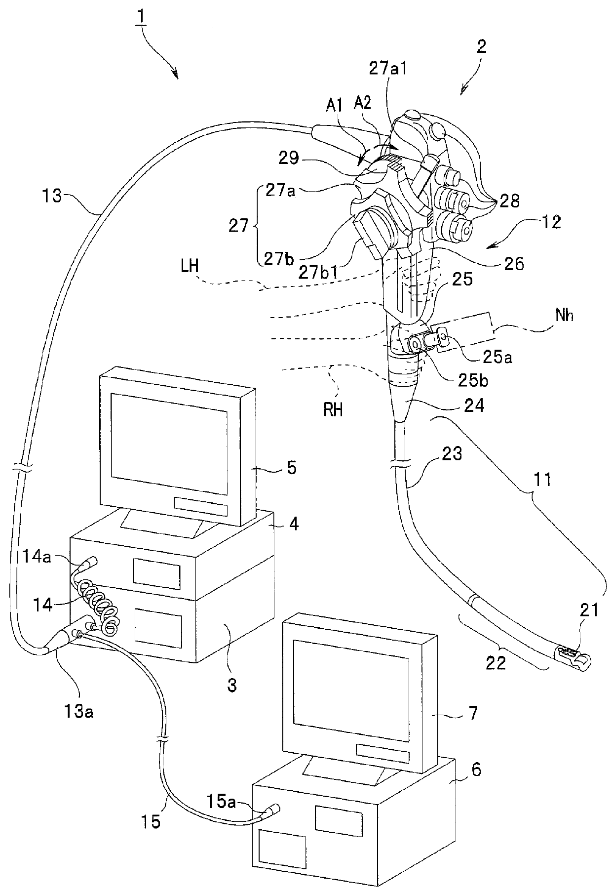 Ultrasound endoscope