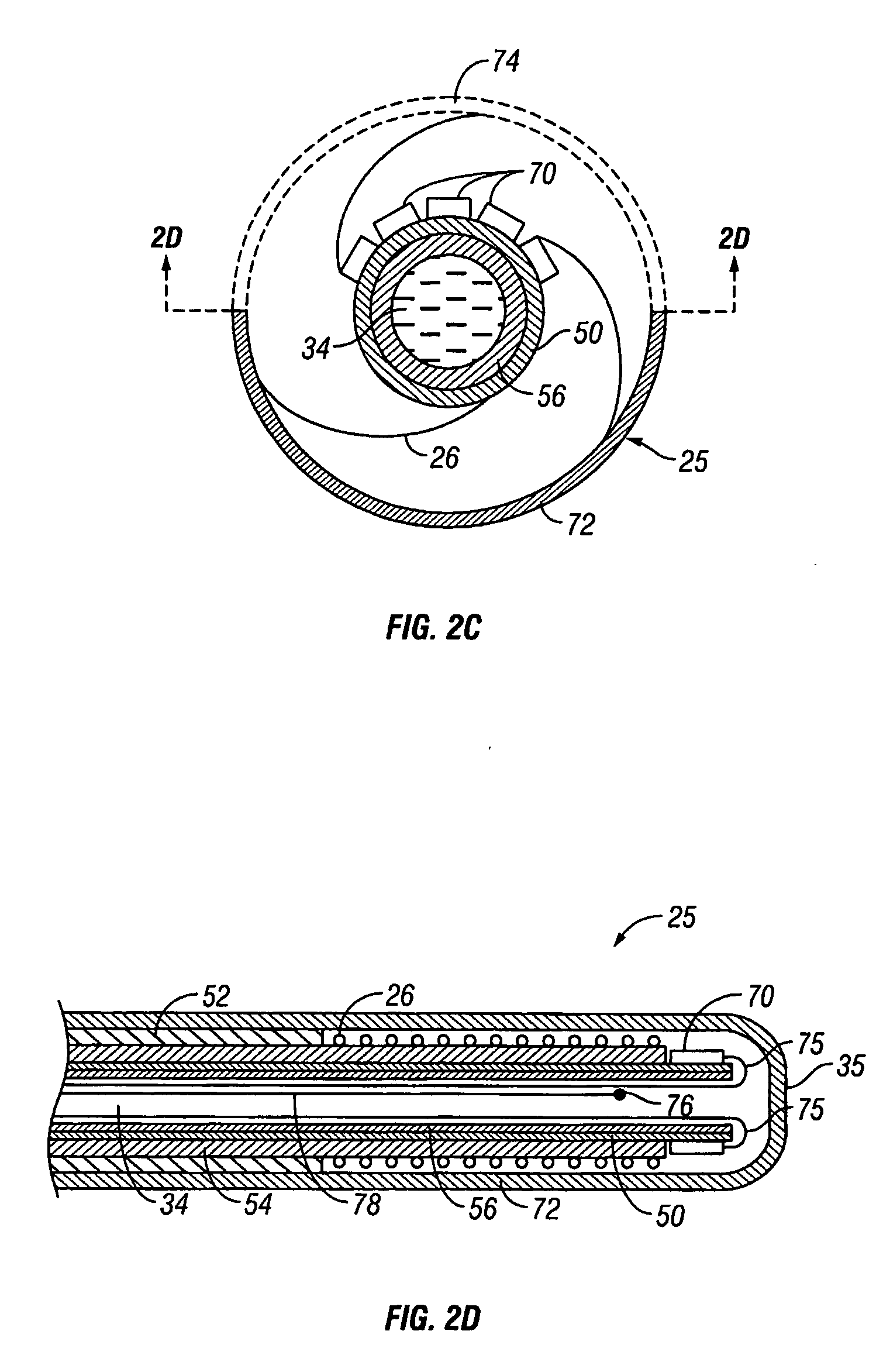 Tissue ablation apparatus and method using ultrasonic imaging