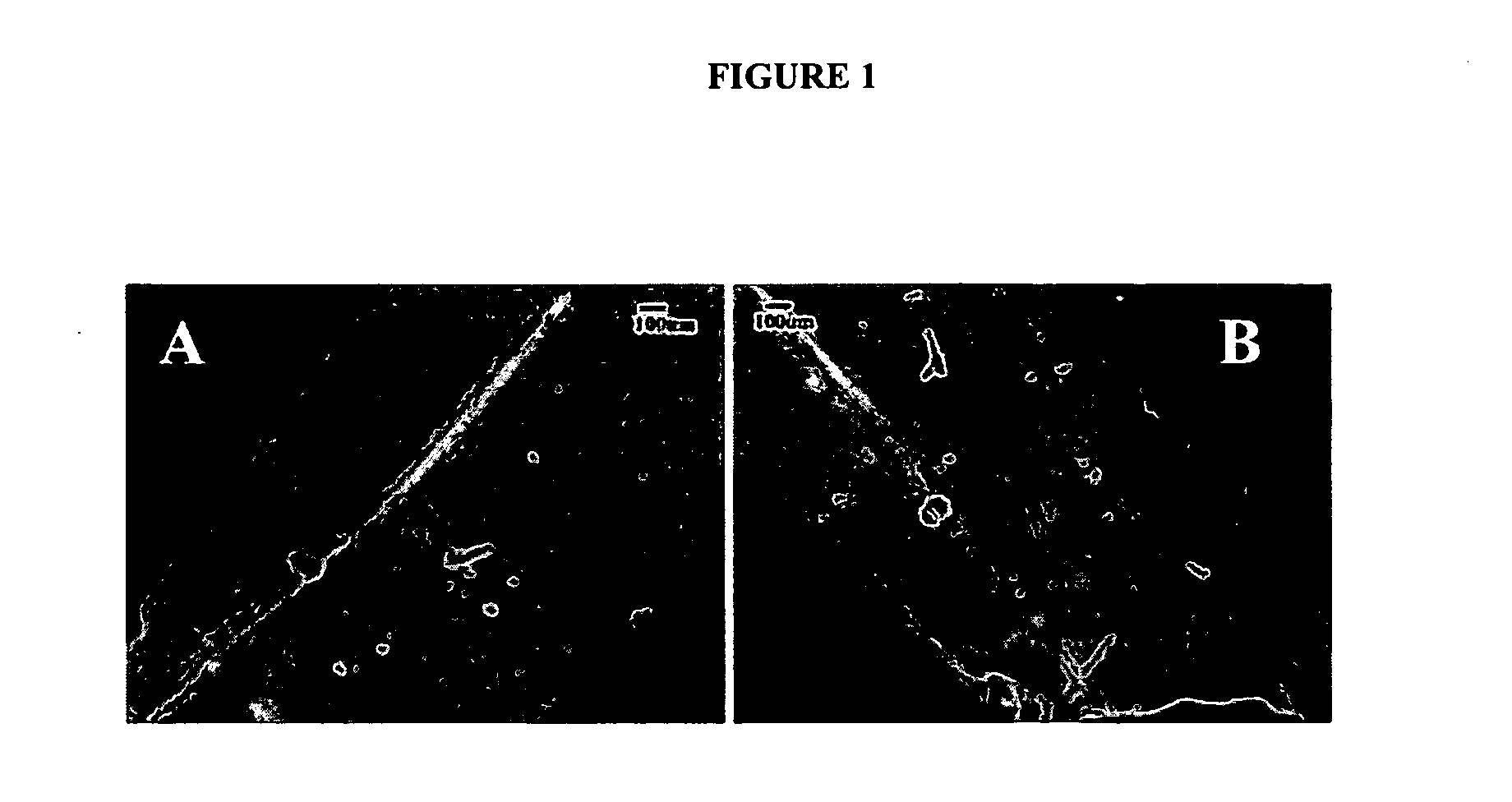 Aligned collagen and method therefor