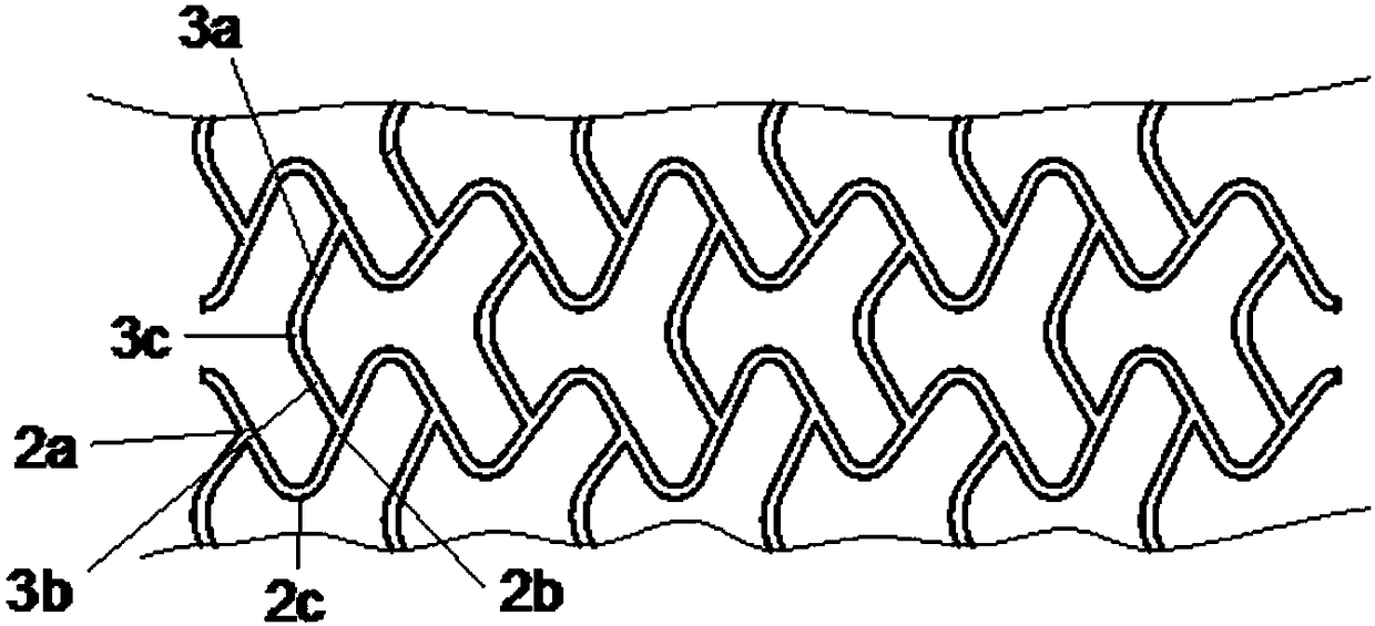 An injection-molded biodegradable polymer vascular stent