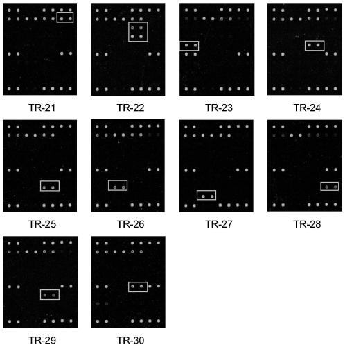 Method for detecting ten kinds of trimethoprim drug resistance genes and kits used