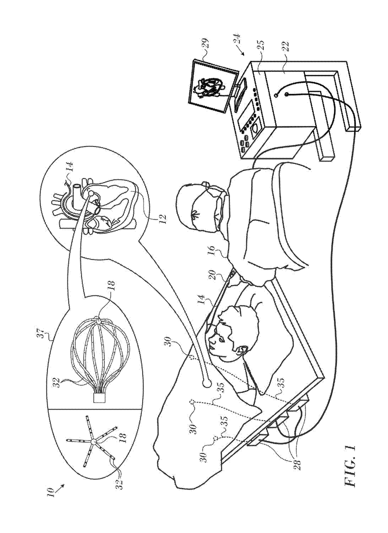 Mesh fitting algorithm