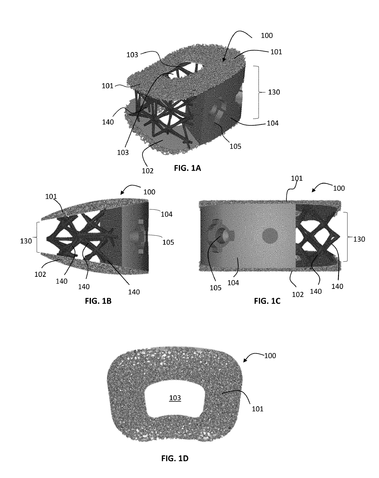 Porous Spinal Fusion Implant