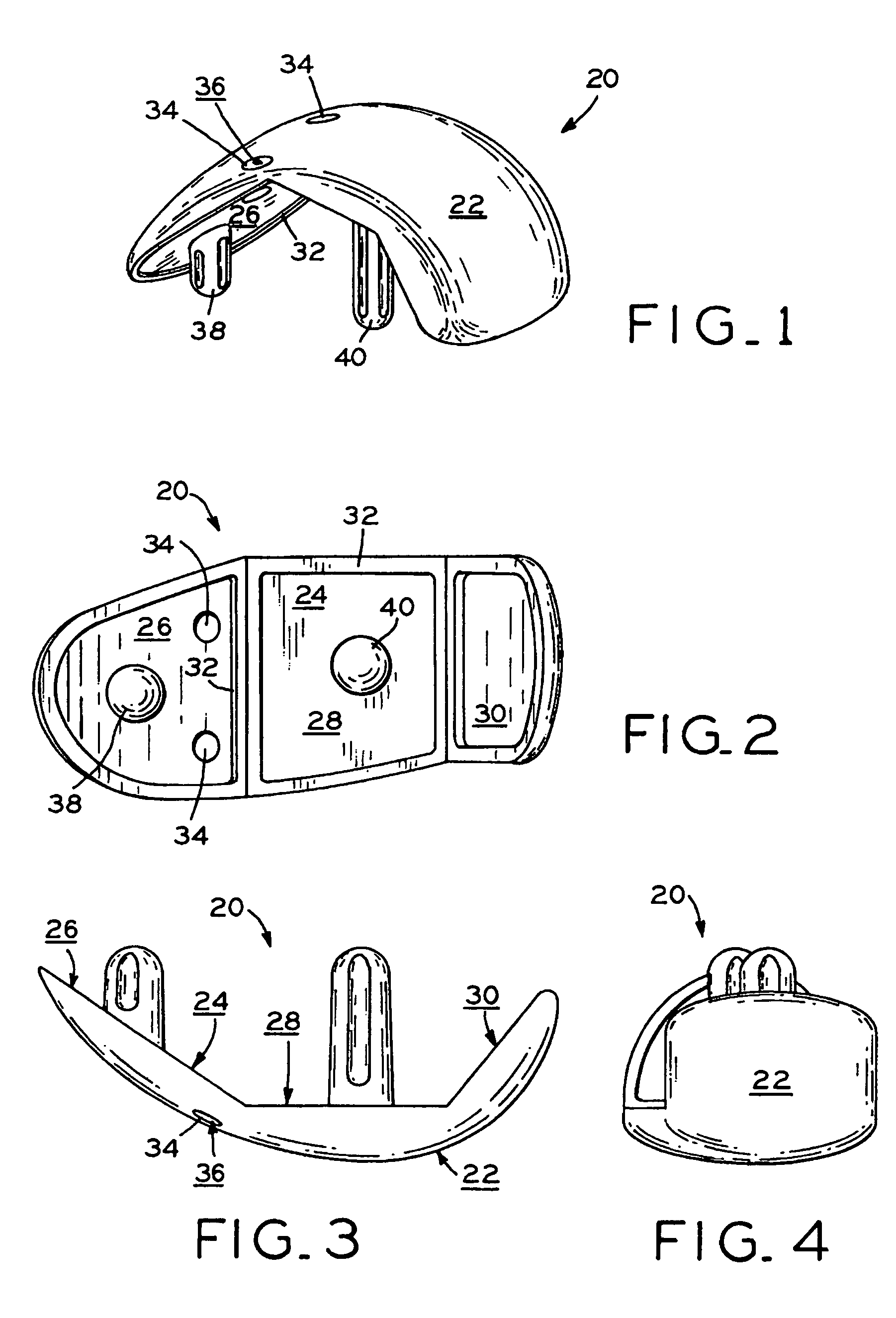 Provisional orthopedic implant and recutting instrument guide