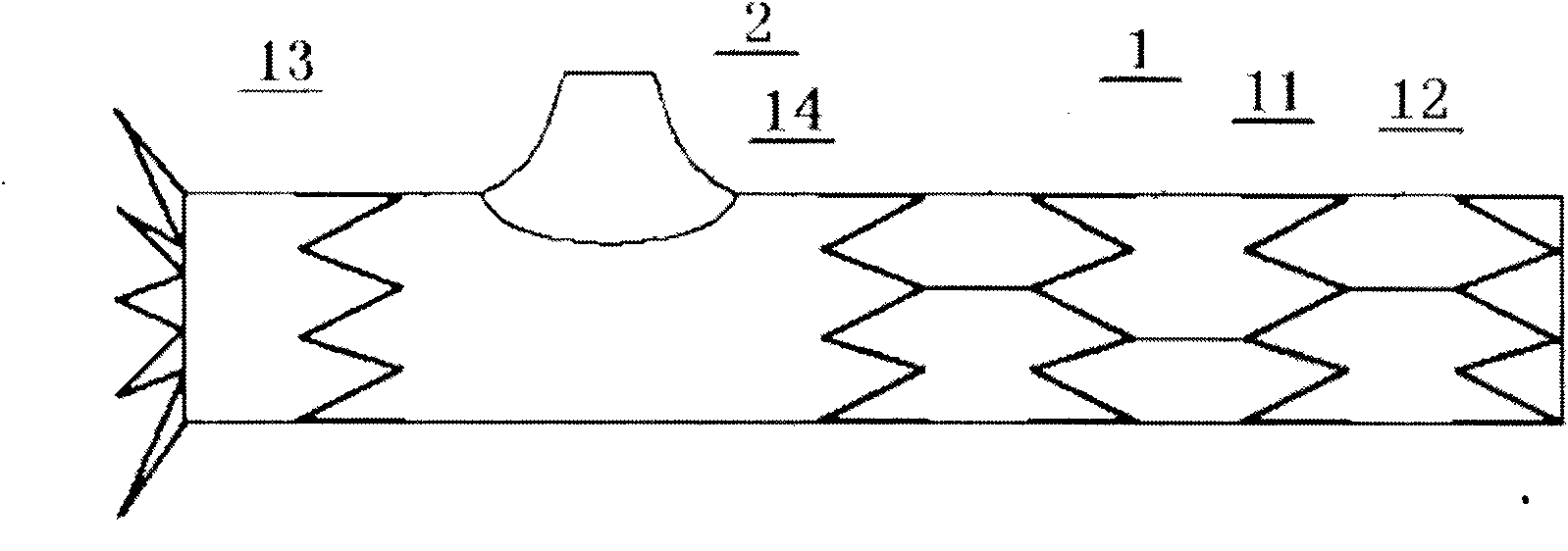 Self-protuberant aortic intracavity implant