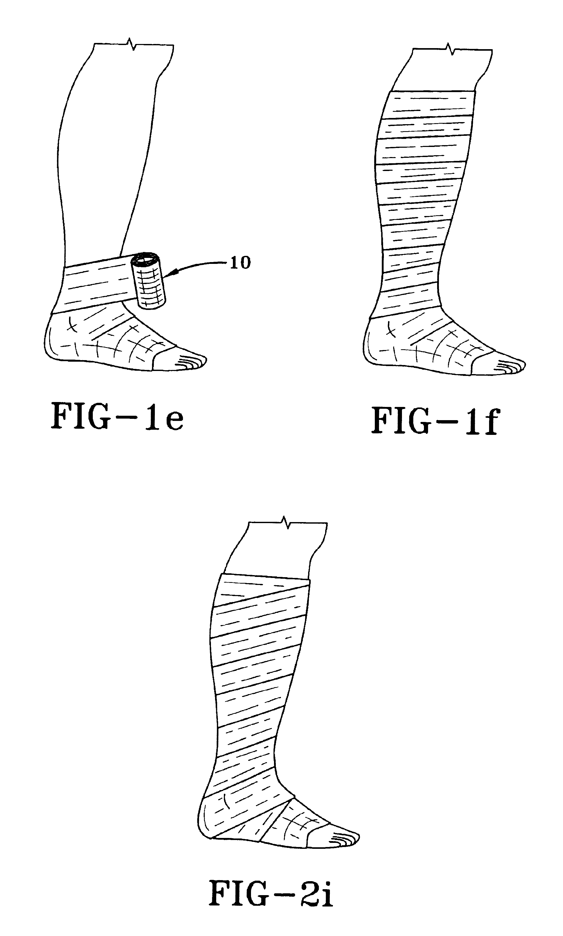 Compression bandage