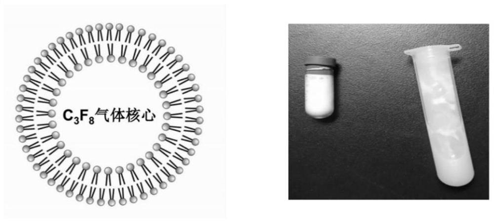 Gene-carrying developing microvesicle used for gene targeted therapy of ischemic heart disease, and preparation method of gene-carrying developing microvesicle