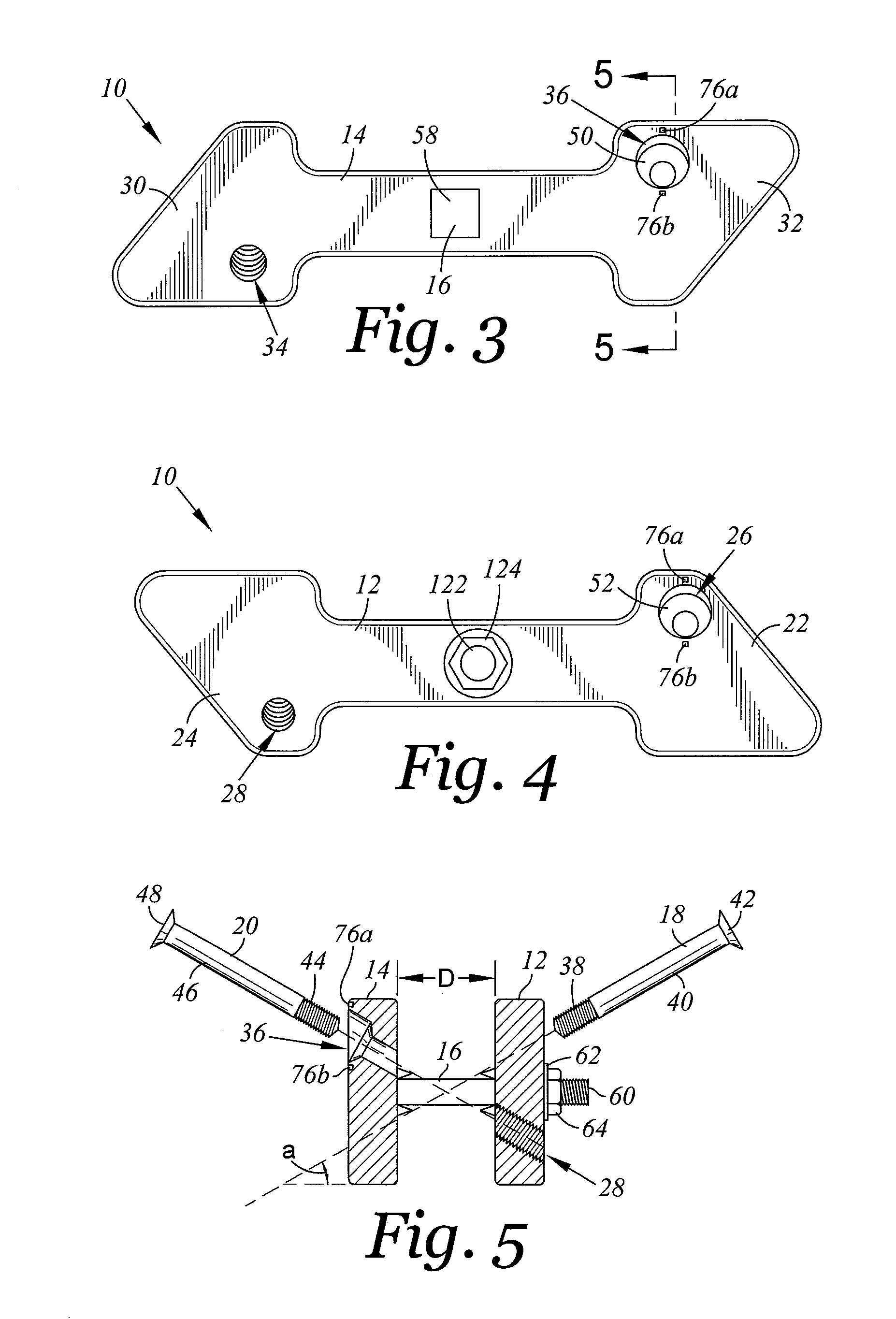 Spinal implant device with fixation plates and lag screws and method of implanting