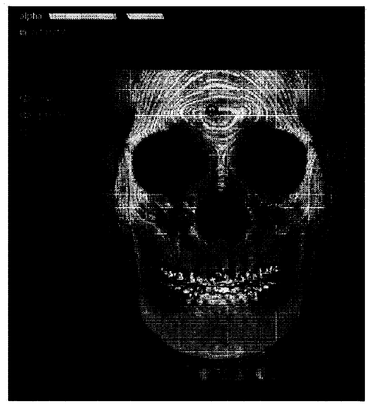 Orthognathic system using three-dimensional hybrid image building program