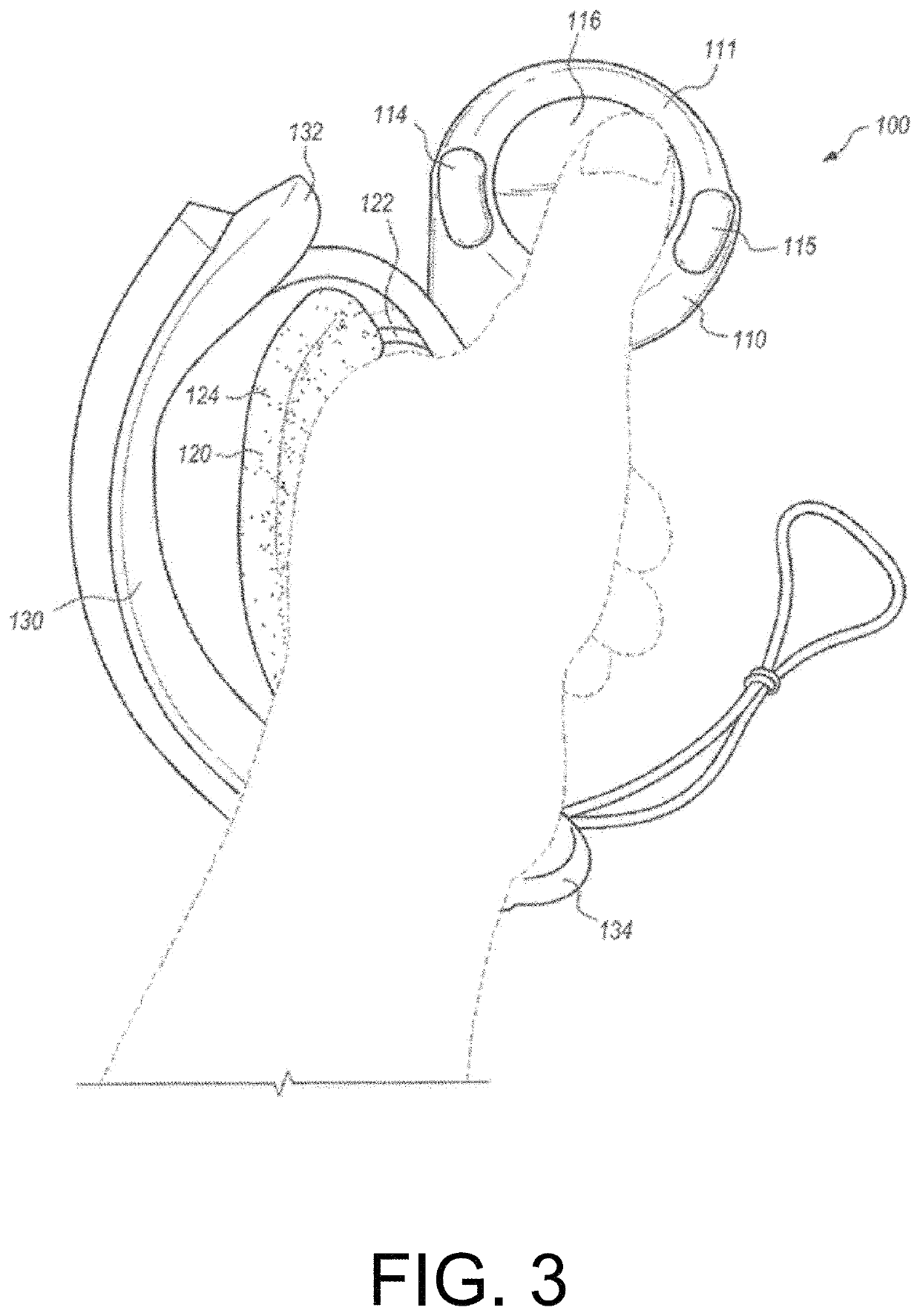 Sensor fusion algorithms for a handheld controller that includes a force sensing resistor (FSR)