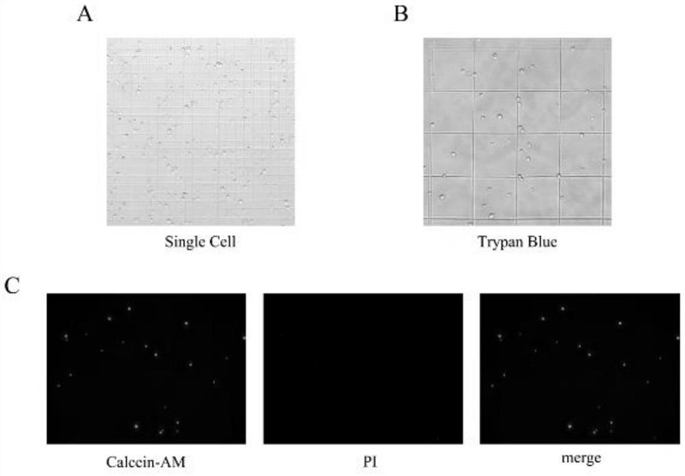 Preparation method and application of bladder urothelial single cell suspension for single cell sequencing