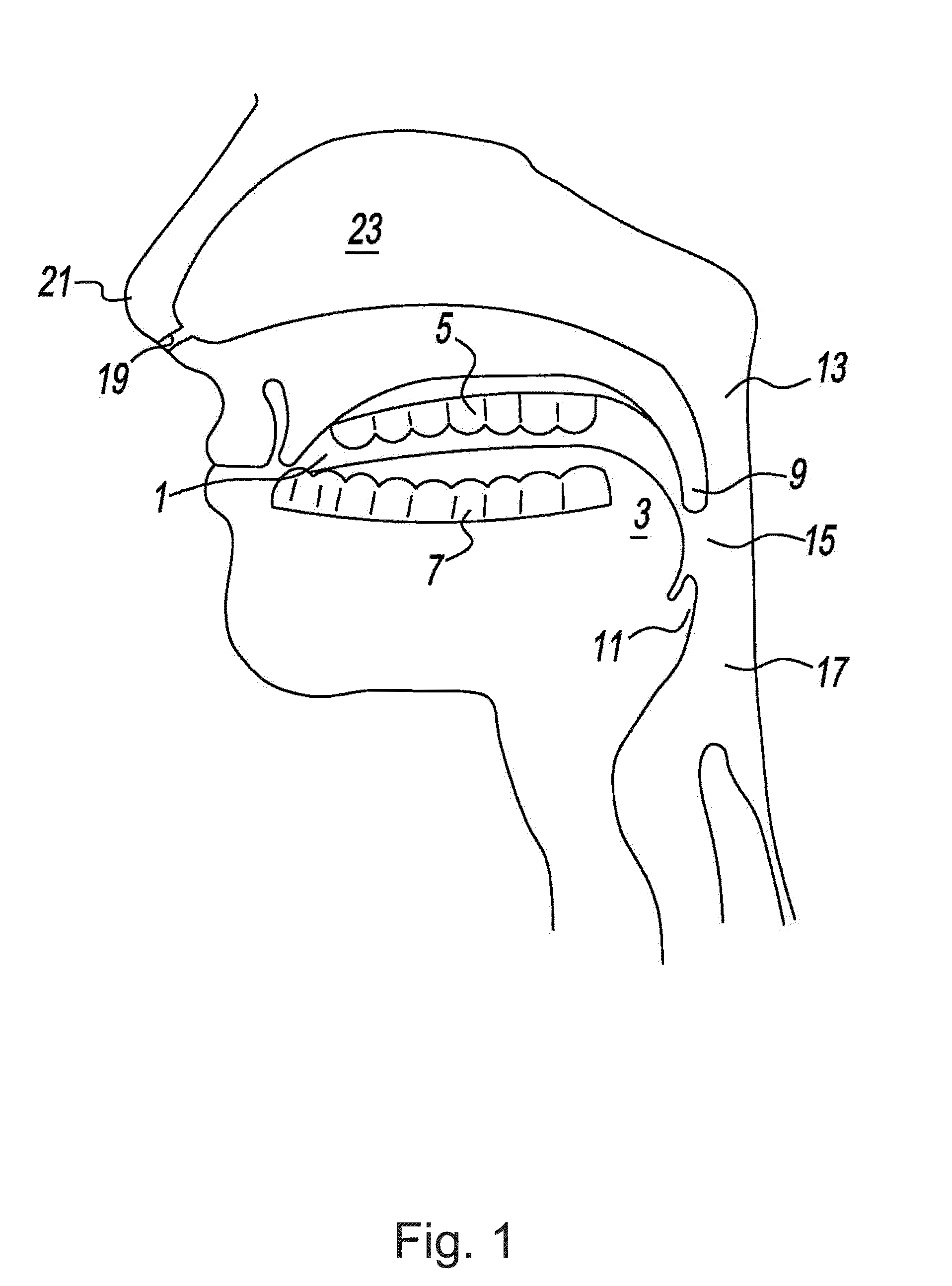 Apparatus and methods for the treatment of sleep apnea