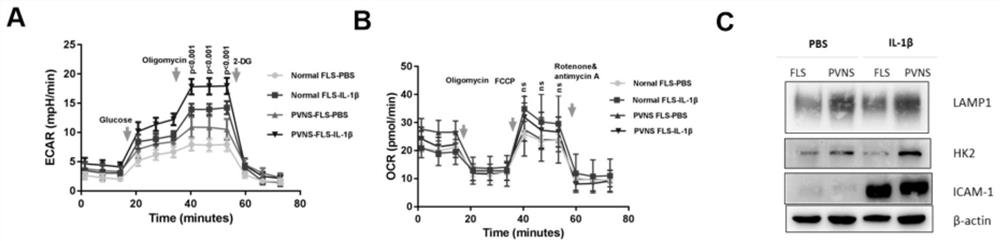 Application of GLUT1 as prevention and/or treatment target of hyperpigmented villus nodular synovitis