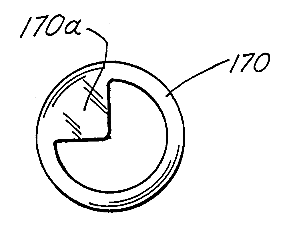 Corneal implant and method of manufacture