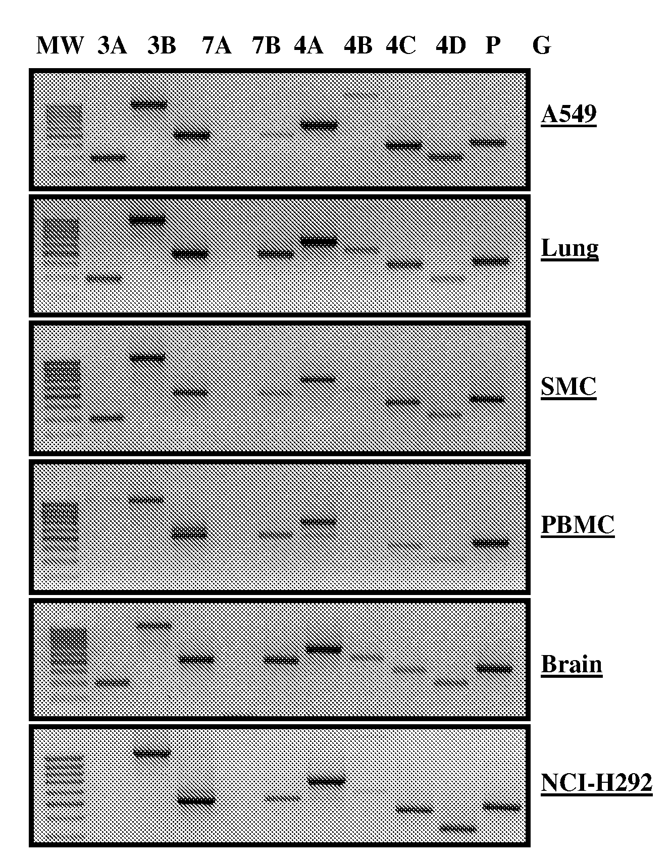 Oligonucleotide compositions and methods for treating disease including inflammatory conditions