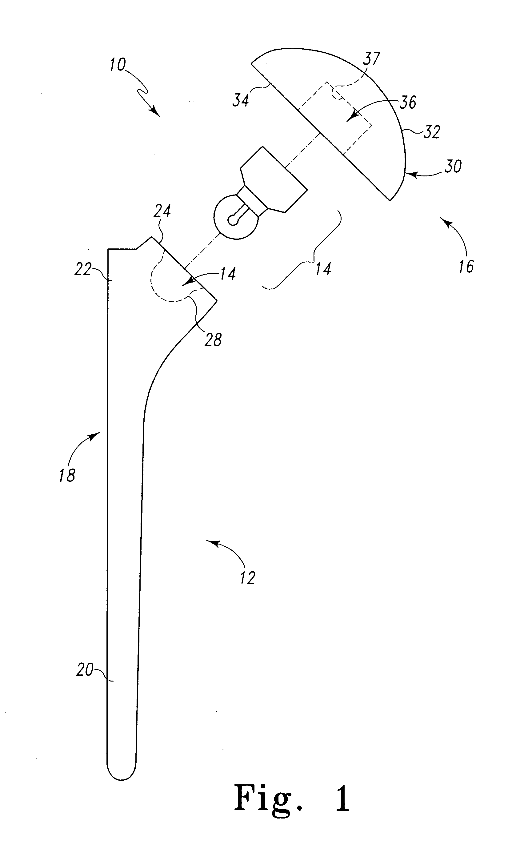 Shoulder prosthesis adjustable humeral head mechanism