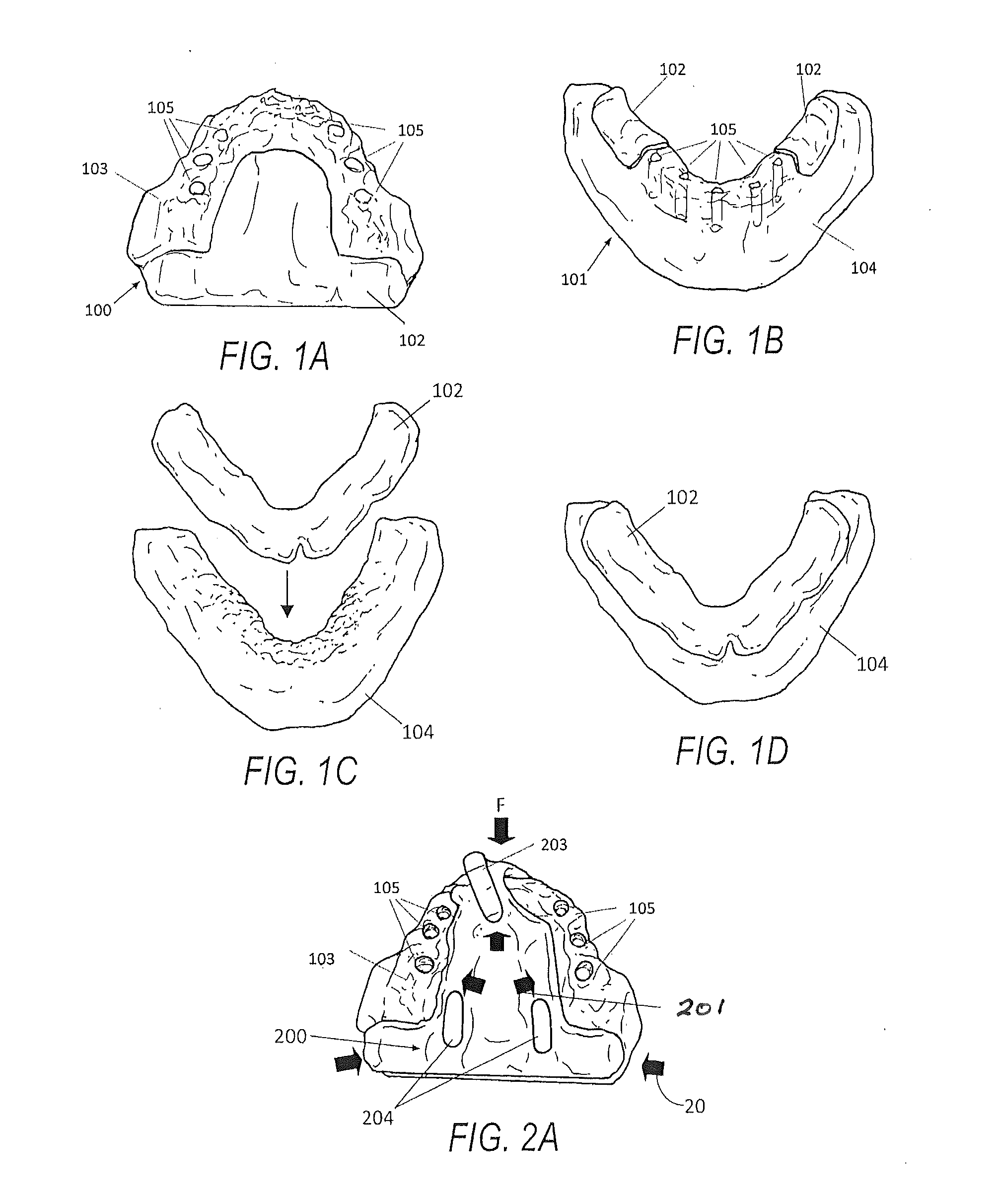 Edentulous surgical guide