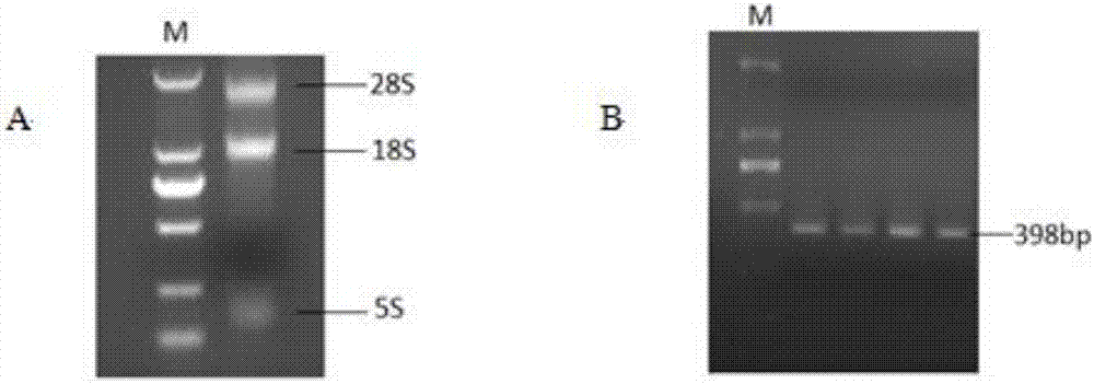 Enterolobium cyclocarpum root transcriptome database, fusion protein, soaking system and silencing system