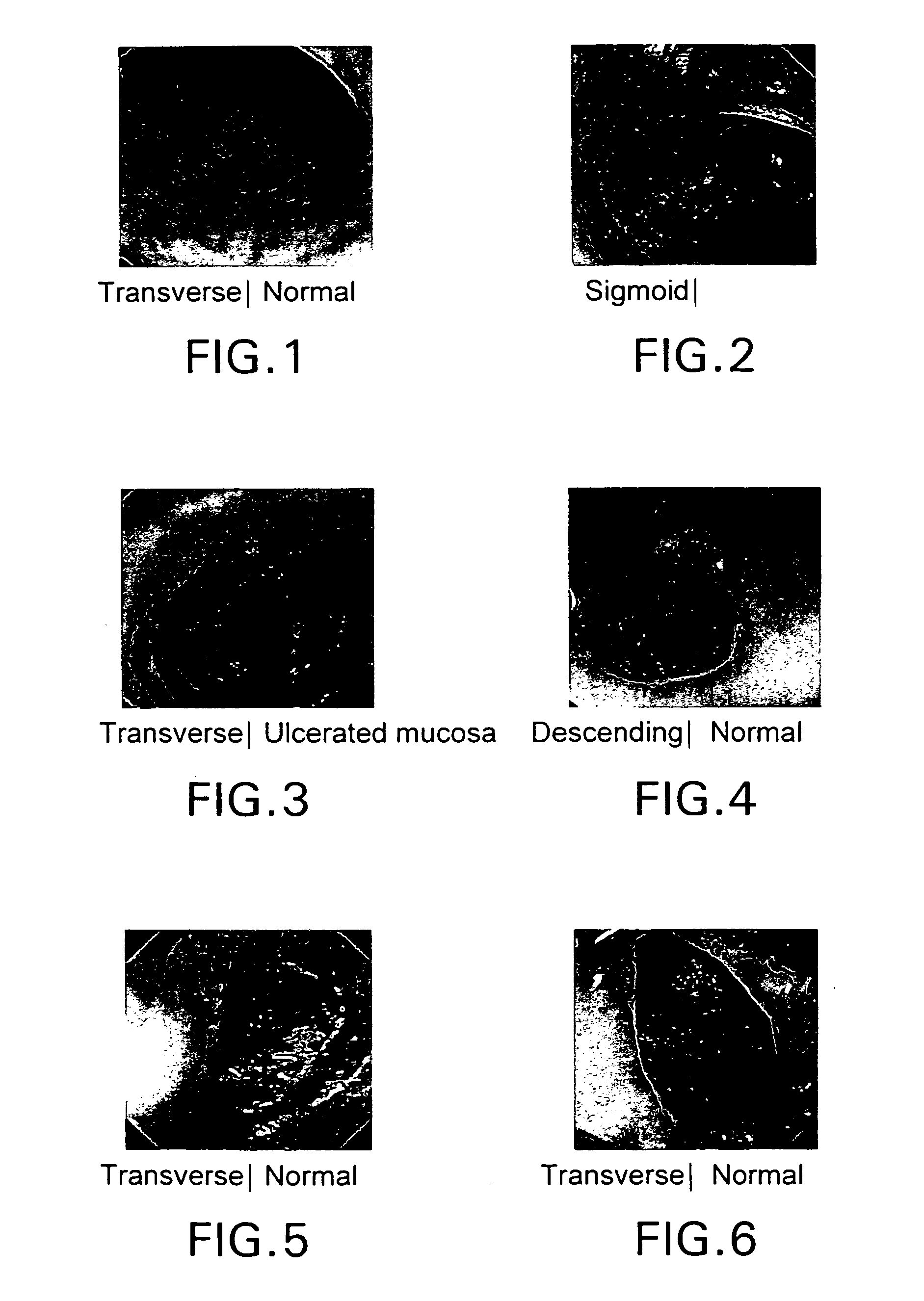 Bowel cleansing composition