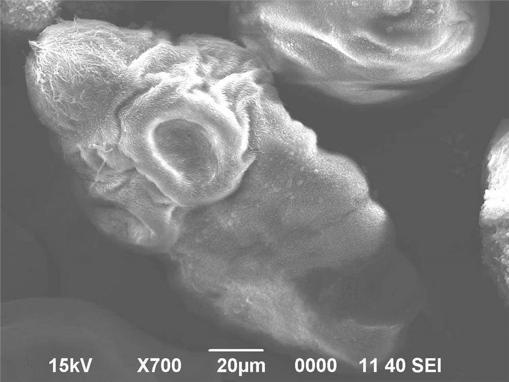 Application of glucose transporter 1 inhibitor WZB117 to preparation of cystic echinococcosis treating drug