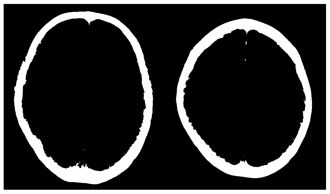 Method and device for identifying brain atrophy