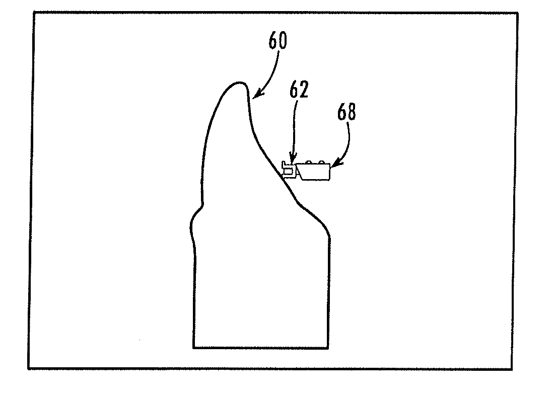 Orthodontic bracket and method of attaching orthodontic brackets to teeth