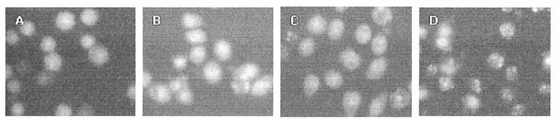 Use of water chestnut extract in preparing medicament for treating leukaemia