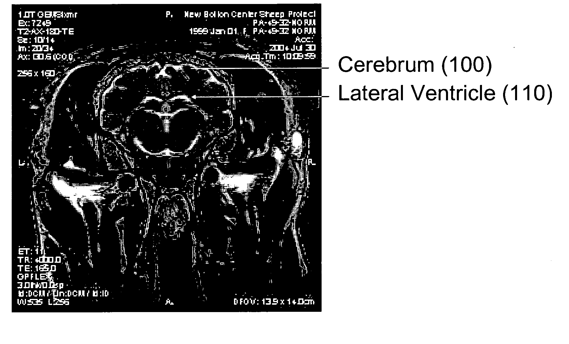 Method for MRI scanning of animals for transmissible spongiform encephalopathies