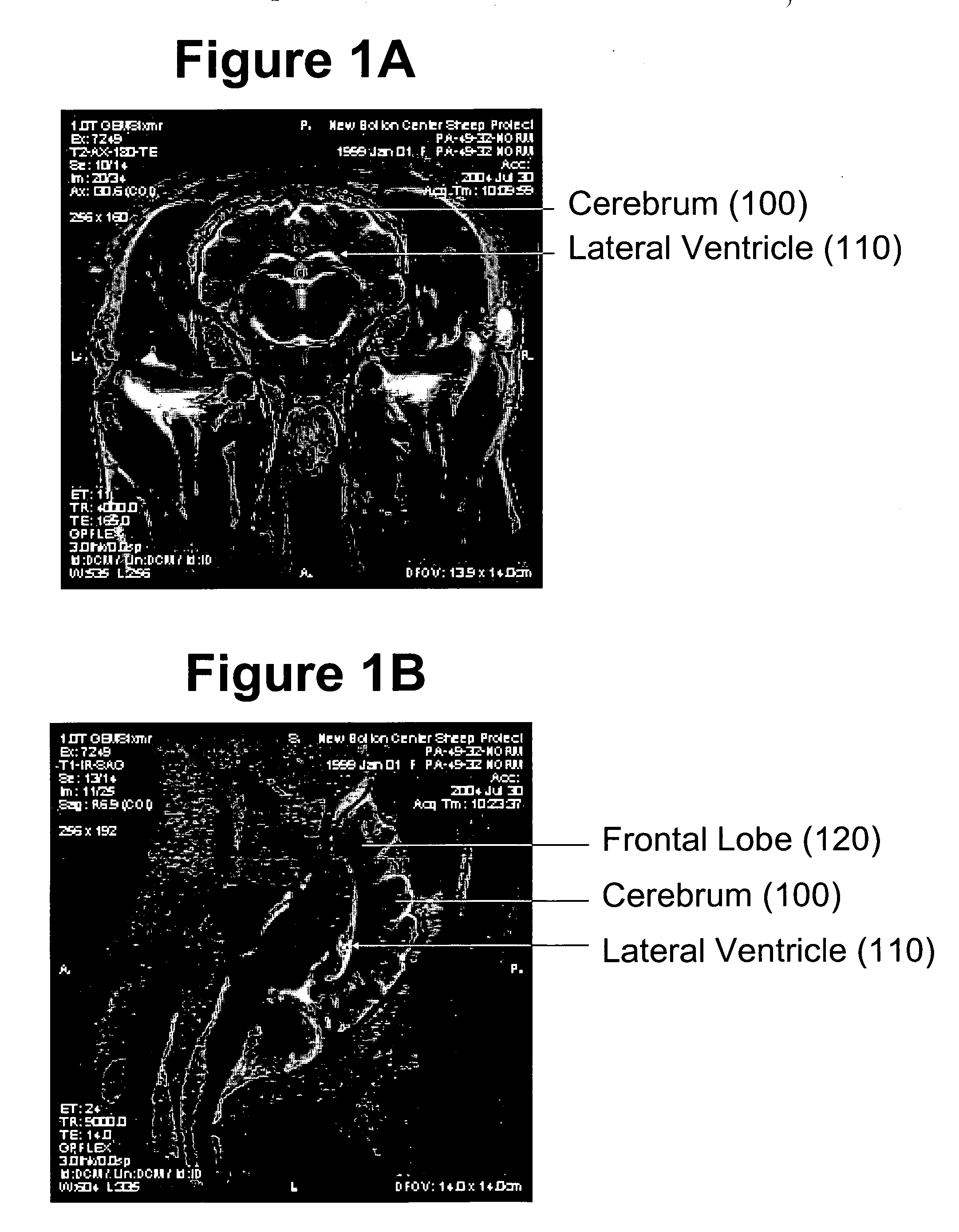 Method for MRI scanning of animals for transmissible spongiform encephalopathies