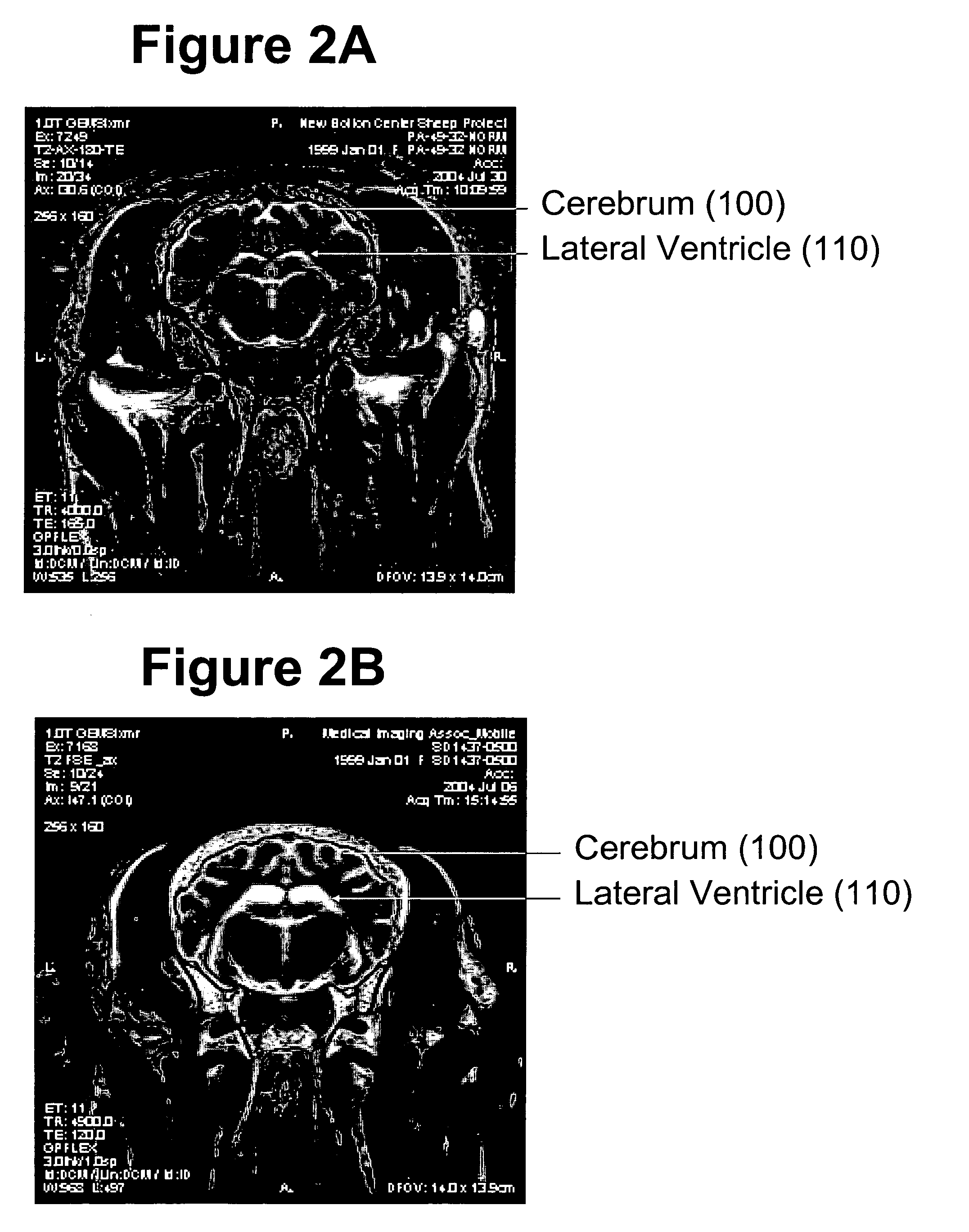 Method for MRI scanning of animals for transmissible spongiform encephalopathies