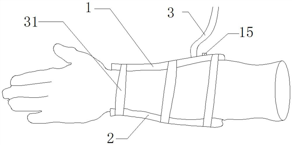 A fracture splint with thermal insulation function