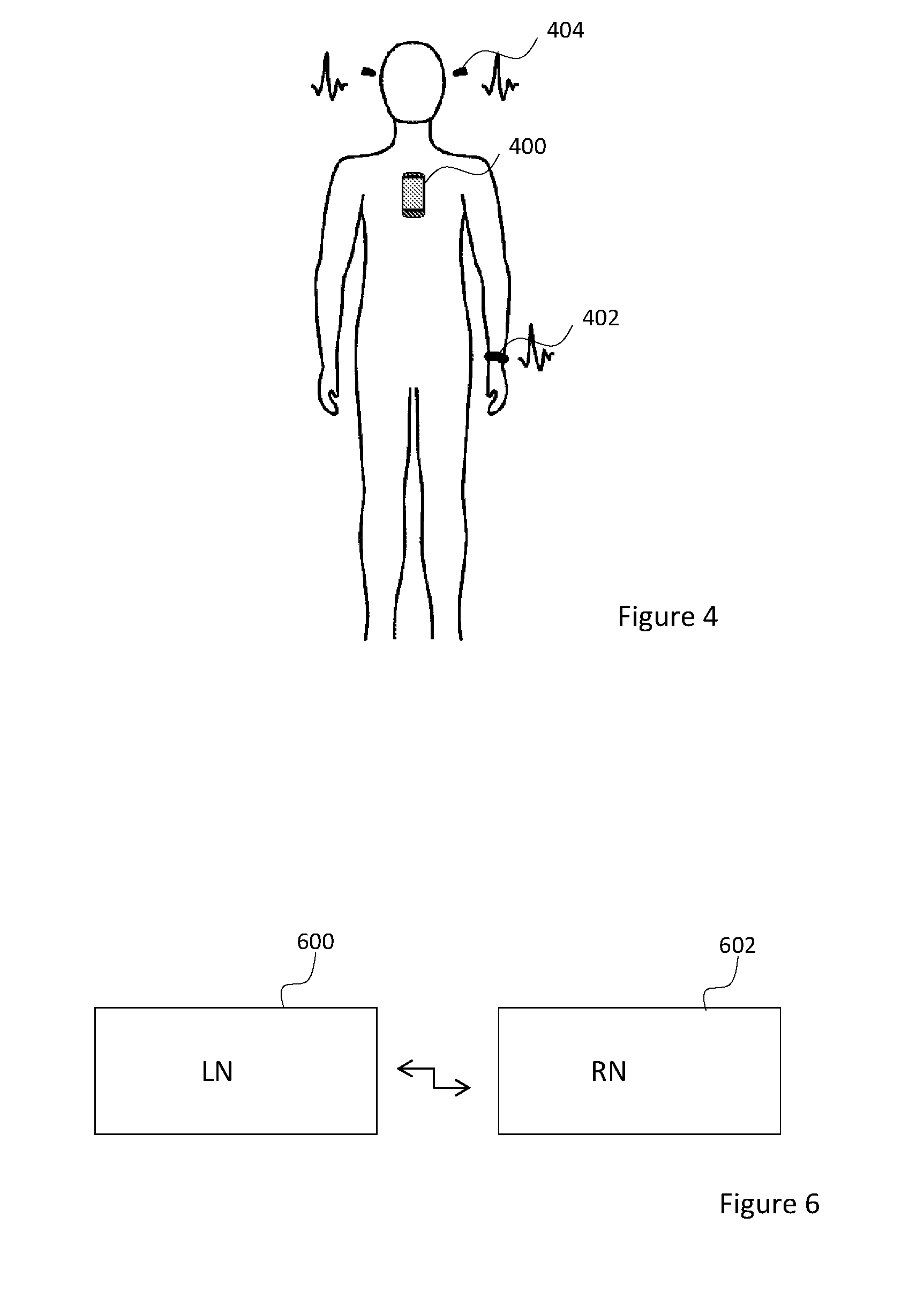 Heart monitoring system