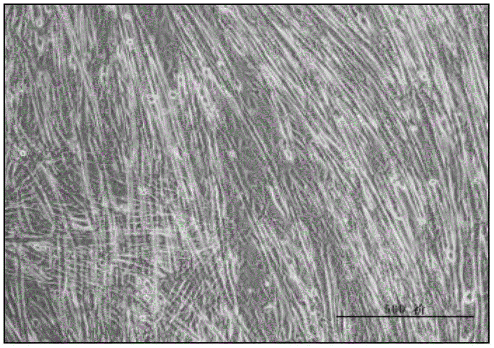 A method for promoting glut4 gene expression in muscle cells