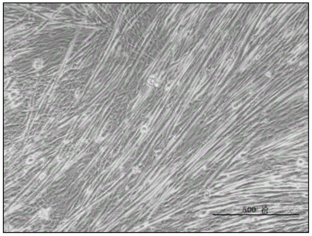 A method for promoting glut4 gene expression in muscle cells