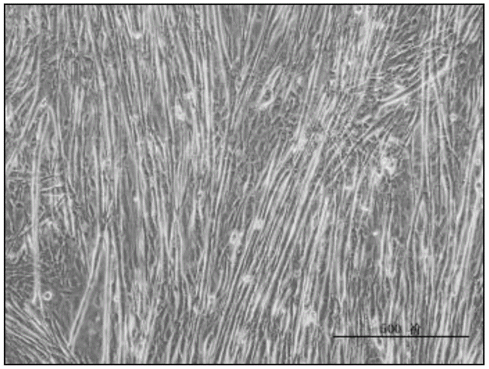 A method for promoting glut4 gene expression in muscle cells