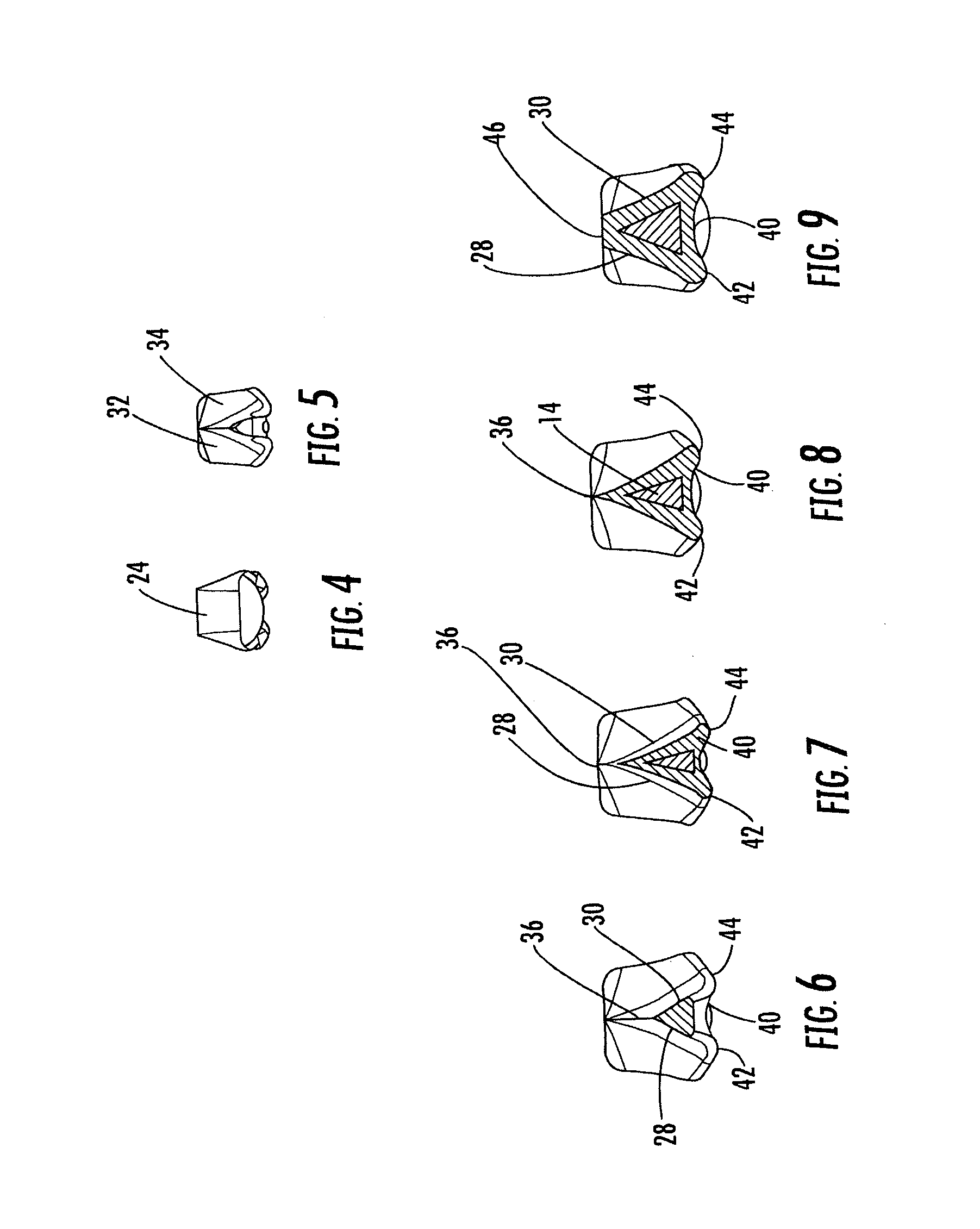 Wedge for use in dental restoration