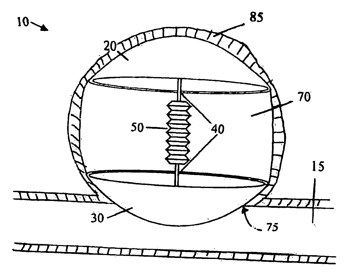 Intra-aneurysm devices