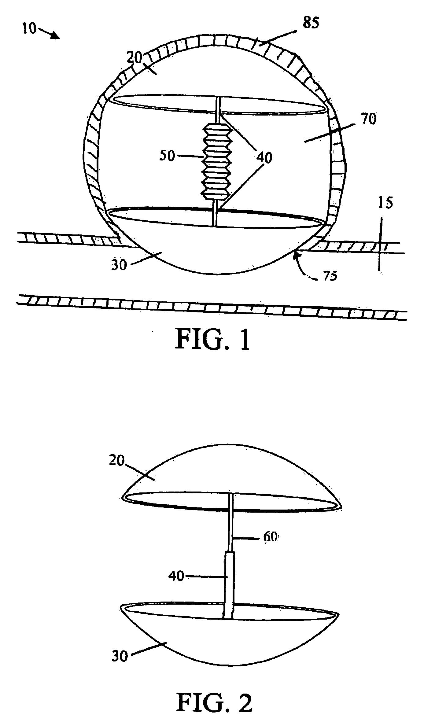 Intra-aneurysm devices