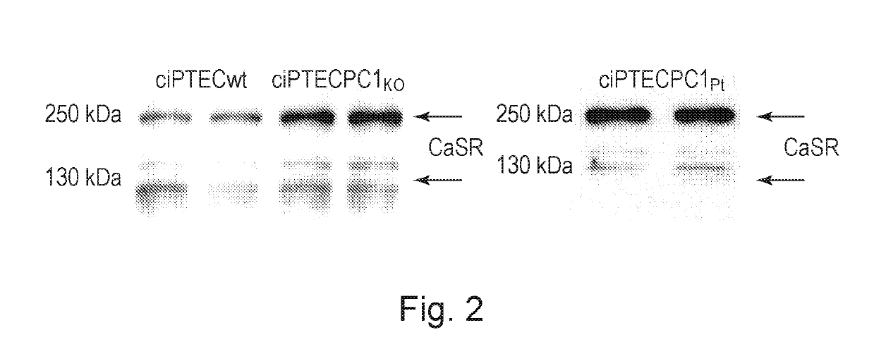 Association of antagonists of the vasopressin receptor and calcimimetics, composition and use thereof for the treatment of polycystic kidney