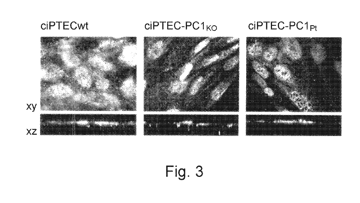 Association of antagonists of the vasopressin receptor and calcimimetics, composition and use thereof for the treatment of polycystic kidney