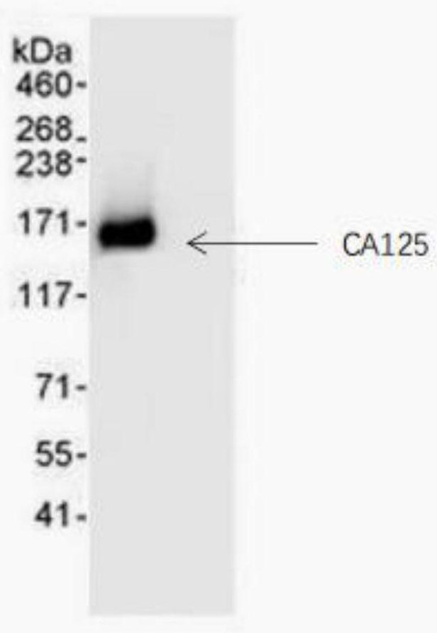 Monoclonal antibody for resisting CA125 protein and cell strain, preparation method and application thereof