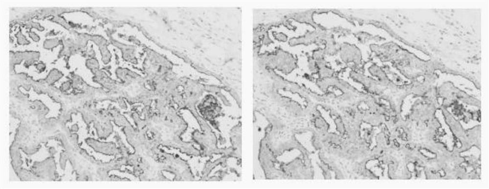 Monoclonal antibody for resisting CA125 protein and cell strain, preparation method and application thereof