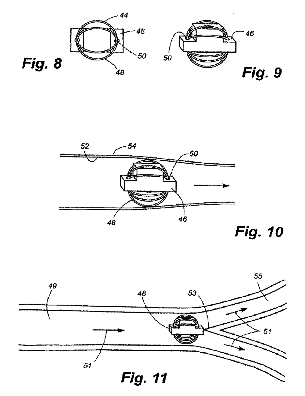 Apparatus and method for sensor deployment and fixation