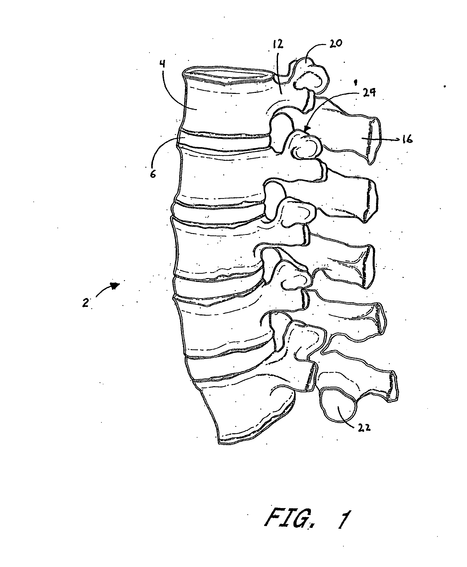 Orthopedic expansion fastener